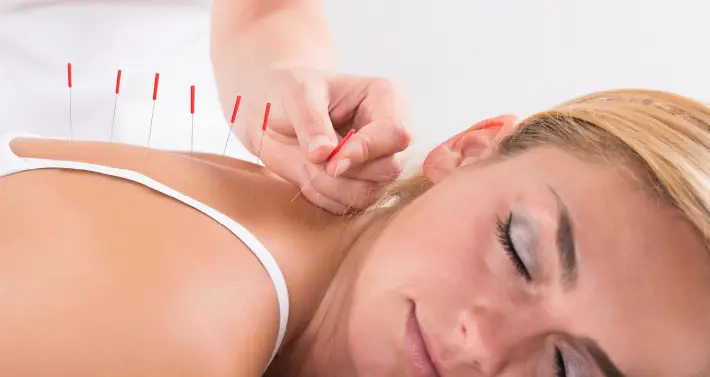 L’Agopuntura in Menopausa
